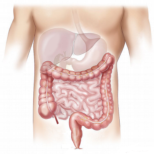 La disbiosi che altera l’asse fegato-intestino
