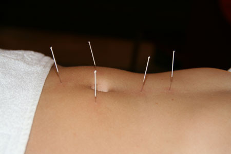 L’Agopuntura nelle algie cervicali: primi risultati