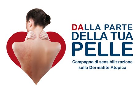 TORINO, Dermatite atopica, campagna in Calabria