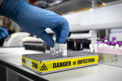 Mantovani: "Test anticorpi non danno patente di immunità"