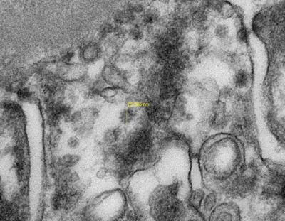 Il coronavirus nel filtro del rene, la foto 'made in Italy'