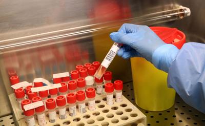 Mantovani: "Test sierologico foglio rosa, non patente immunità"