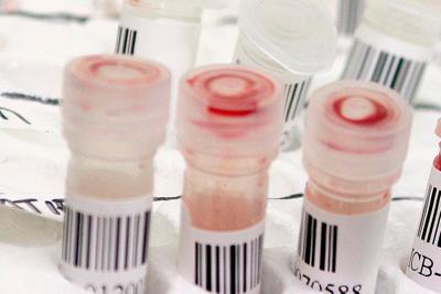 Coronavirus, Fontana: "Trovato test sierologico affidabile per anticorpi"